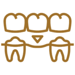 Dental Crowns and Bridges