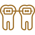 Custom Aligners