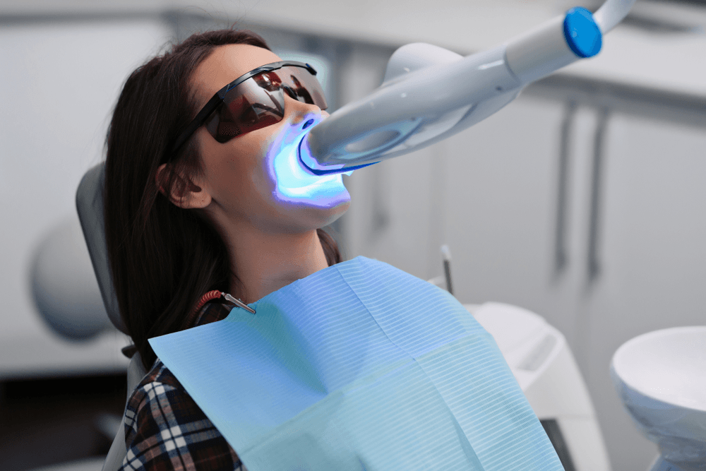 professional teeth whitening