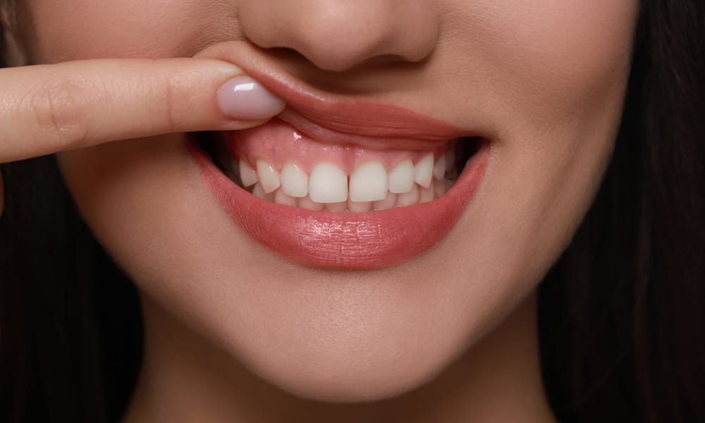 Aurora Smiles' Guide to Maintaining Healthy Gums